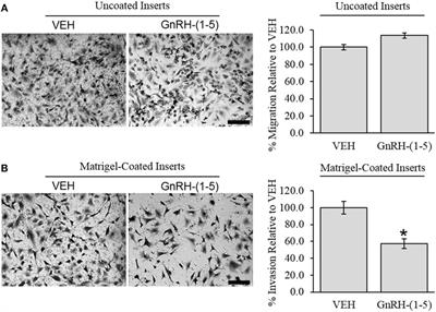 GnRH-(1–5) Inhibits TGF-β Signaling to Regulate the Migration of Immortalized Gonadotropin-Releasing Hormone Neurons